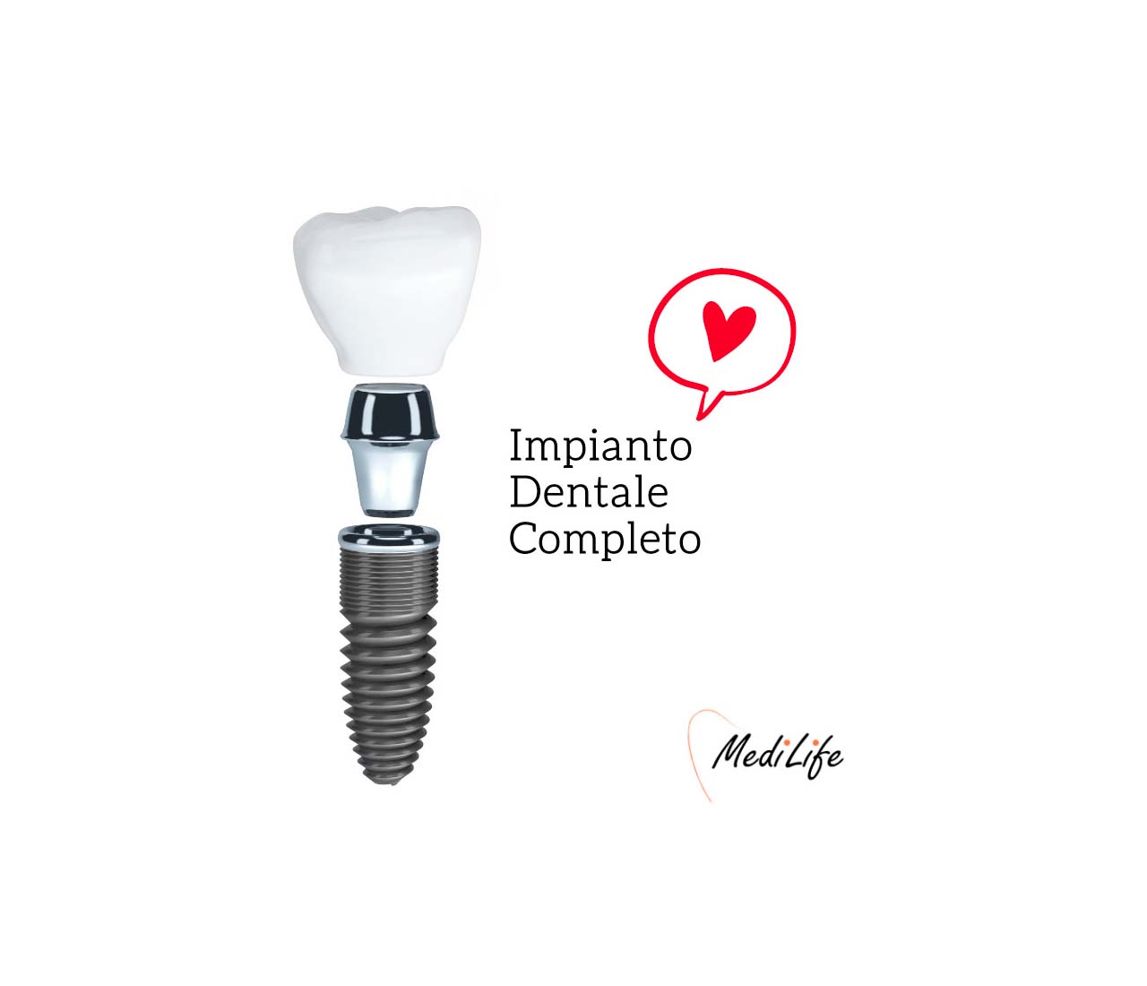 Impianti dentali a carico immediato - denti fissi in 24 ore - MediLife  Clinic